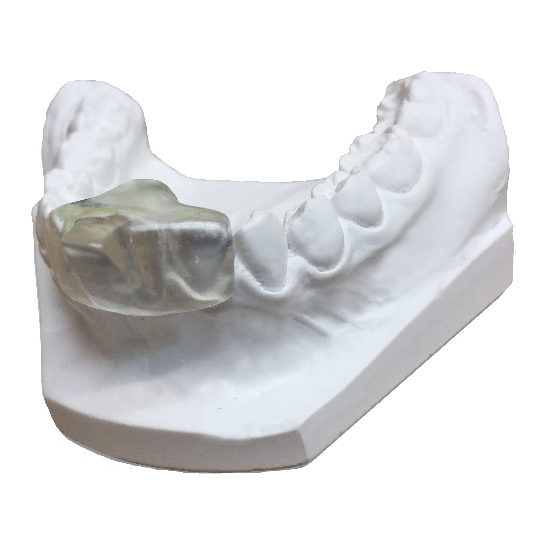 Bruxism Device